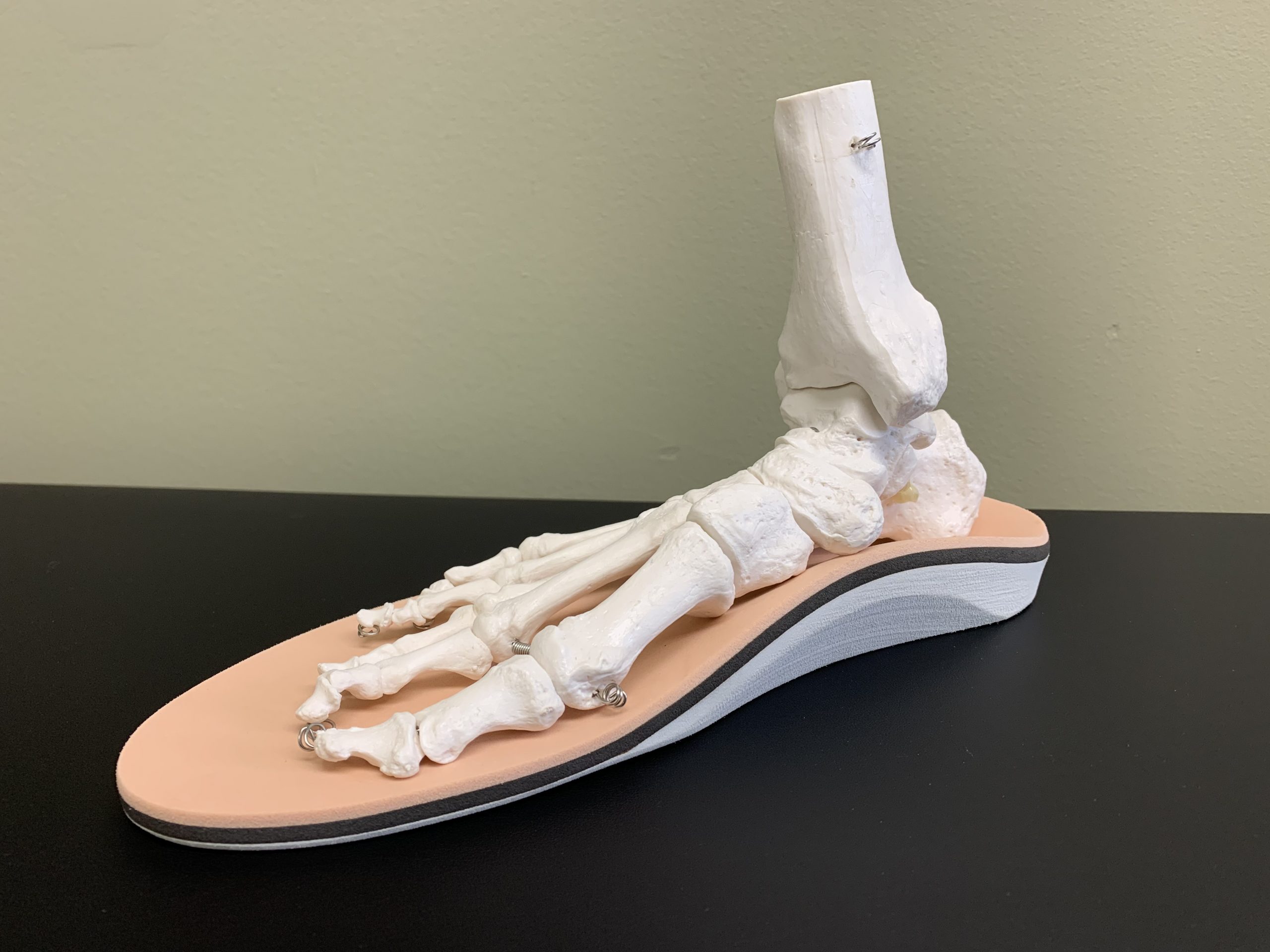 Custom Foot Orthotics In Guelph Applied Biomechanics