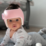 A photo of an infant wearing a cranial remolding helmet, on their tummy on the carpet.