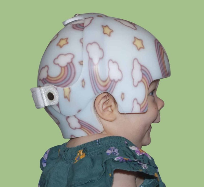 A baby wearing a bi-valve cranial remolding helmet with a sublimated rainbows and stars design.