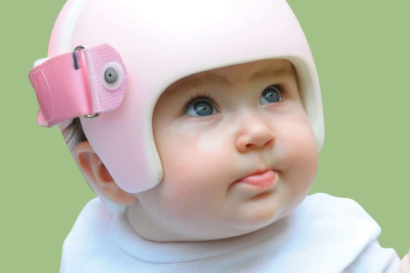 A baby wearing a pink cranial remolding helmet.